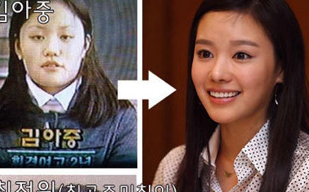 裴勇俊李英爱孙艺珍+揭露韩国明星的整容秘闻