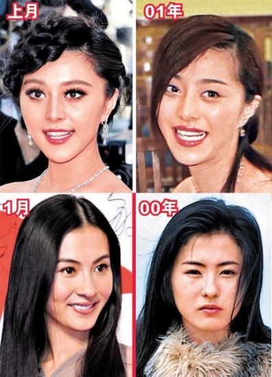 化妆师曝明星整容名单