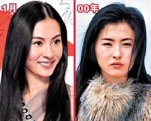 化妆师曝明星整容名单