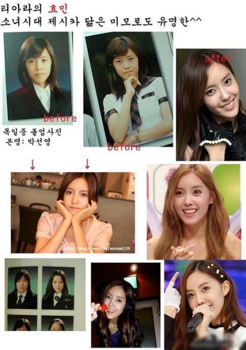 少女时代郑丽媛<em>T-ara</em> 盘点<em>韩国女星</em>整容后遗症