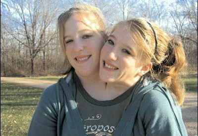 双头<em>姐妹</em>一个身体两个头 揭秘两人不为人知的