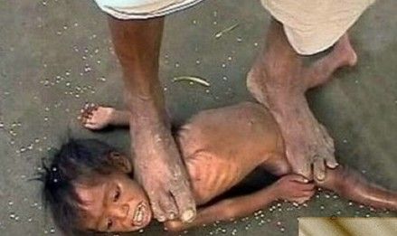 美女医生裸露身体为患者治病