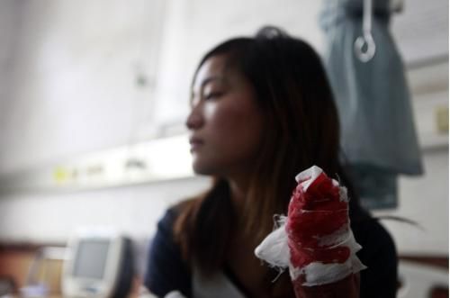 【砍手环卫工】太可怕了!女子被环卫工砍断手指竟只因乱丢垃圾(组图)_理财频道_华讯财经