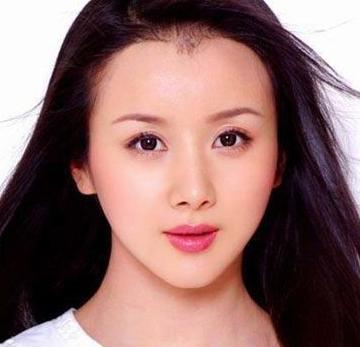 图揭明星整容后遗症 Baby柳岩嘴歪脸僵硬