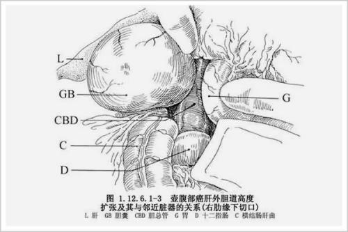 那是他的战利品:一个老教授赌他不可能完成一个难度极大的手术,他