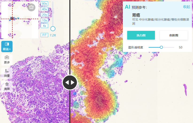 【稿件】《AI破局医疗“不可能三角” 京东云推动大模型全面走向深度应用》