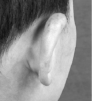 老师体罚6岁男童右耳被打肿,现在的幼儿园怎么成了虐童场所?